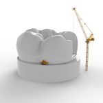 Tooth Funny Crane Building 2869725 150x150